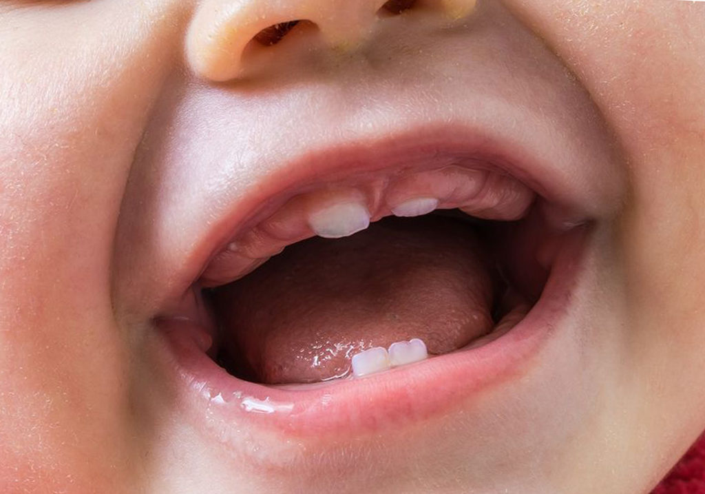 Как снять боль при зубах